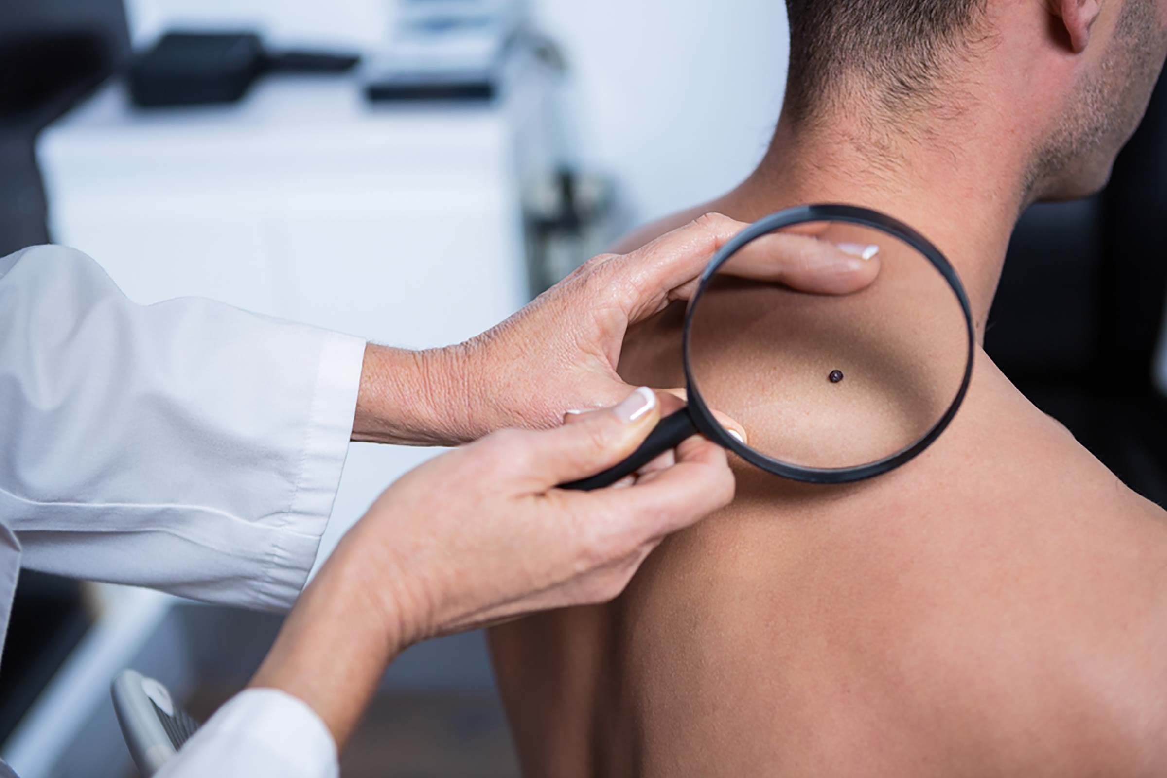 Skin Cancer in Chester & Hackettstown, NJ
